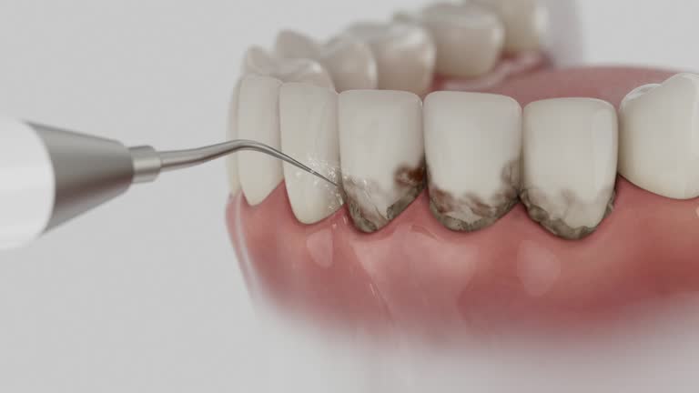 Trusted Wisdom Tooth Removal service in Doolittle, TX - Dentist Open Now
